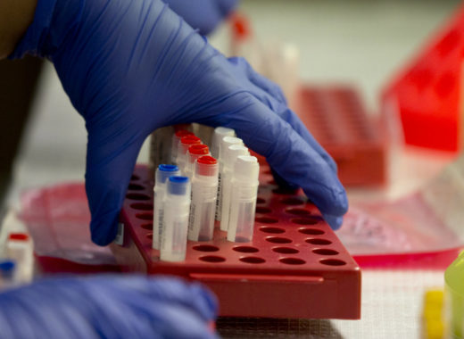 12 laboratorios clínicos han cerrado en Anzoátegui por falta de reactivos