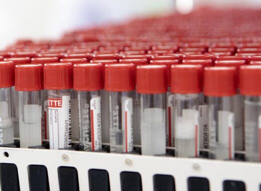 Científicos chinos logran un test anticovid ultrarrápido y tan preciso como una PCR