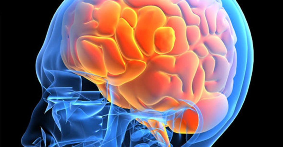 cerebro