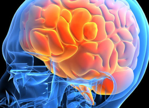 cerebro