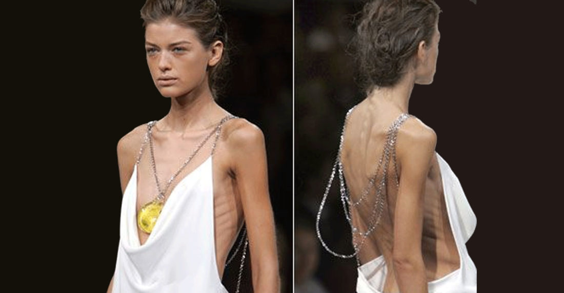 modelos, anorexia, francia, bulimia