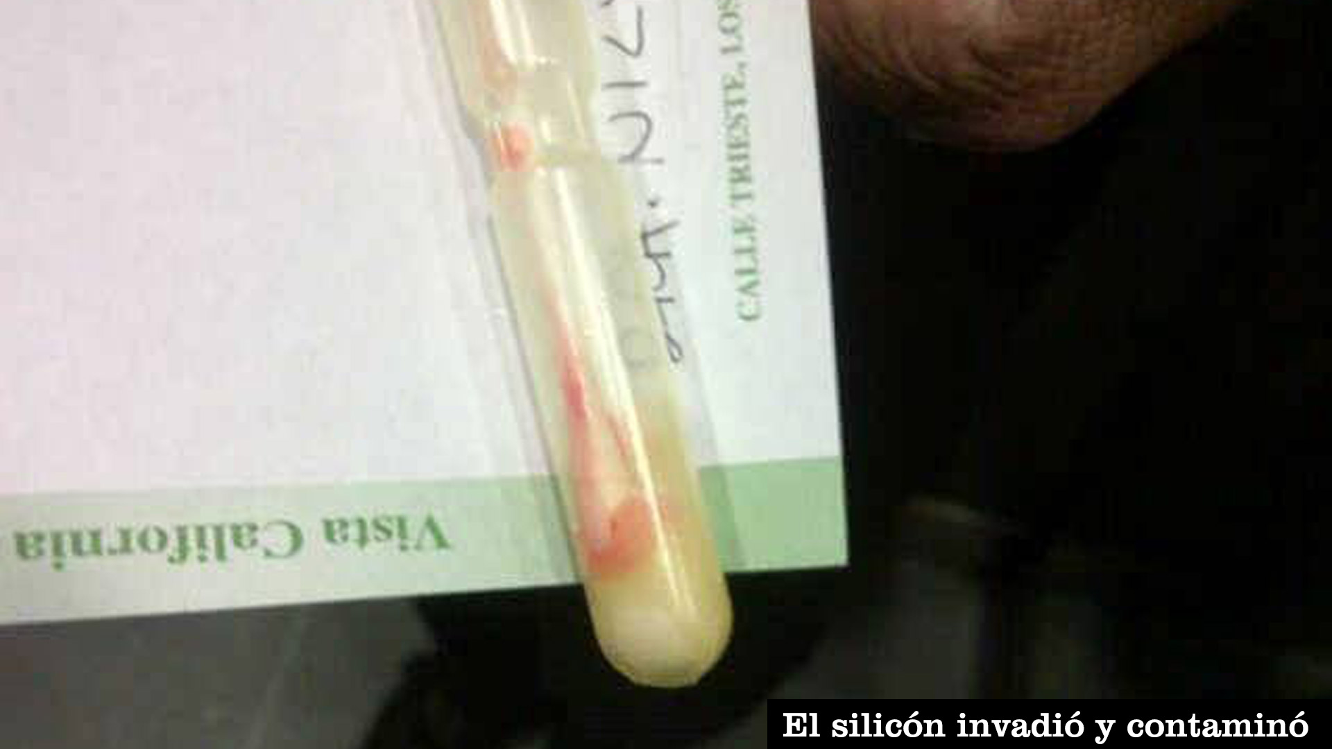 Implantes4