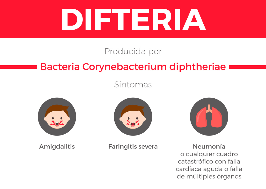 Difteria