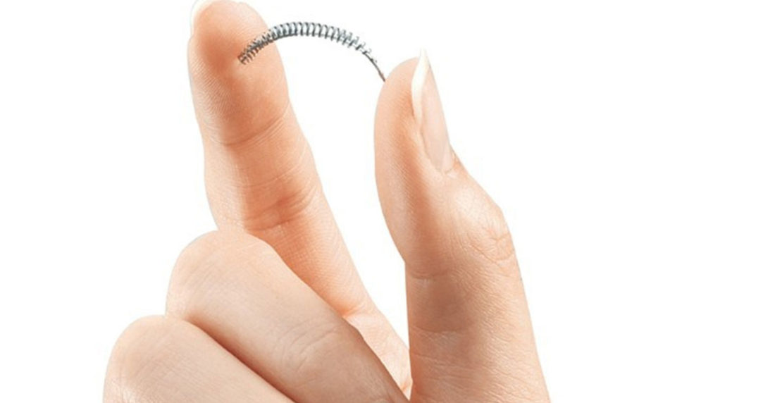 essure, anticonceptivos