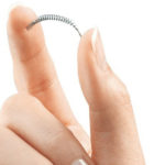 essure, anticonceptivos