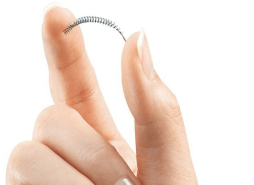 essure, anticonceptivos