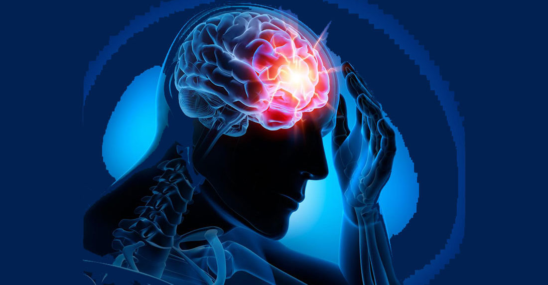 epilepsia
