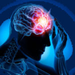 epilepsia