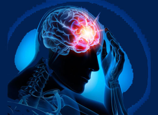 epilepsia