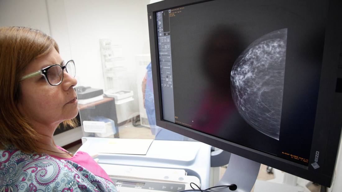 EE-MAMOGRAFIAS-DANIELH-9