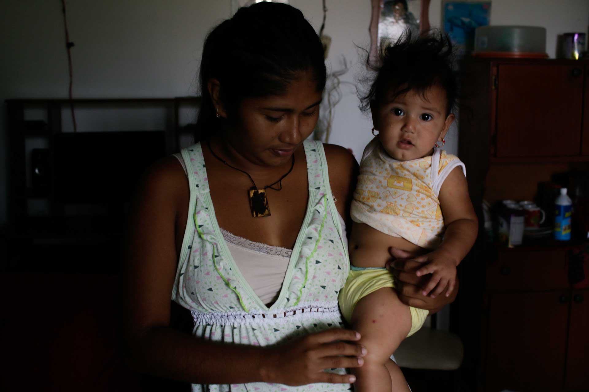 Escabiosis niña madre