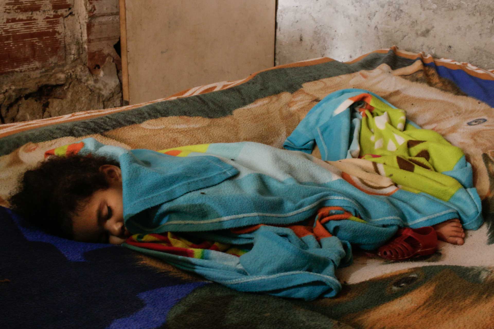 Escabiosis niño dormido