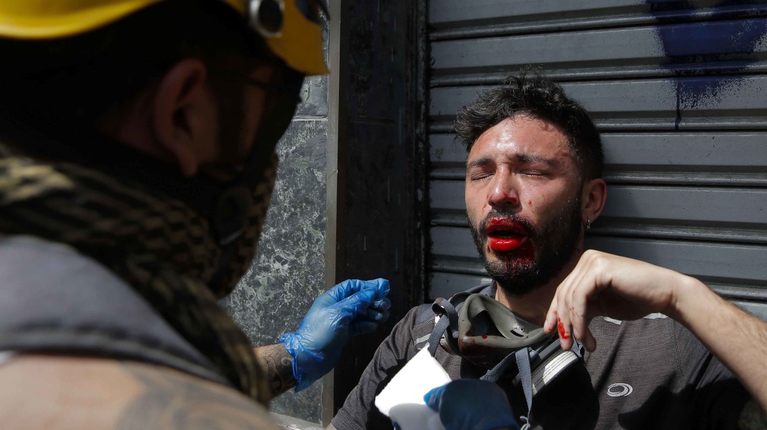 CHILE-CRISIS-PROTEST