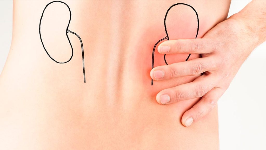 Cuidado con los excesos navideños: pueden dañar los riñones