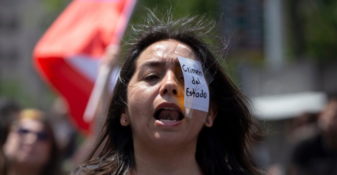 Son las heridas provocadas por estas armas las que causan más consternación entre las autoridades médicas. En especial, las lesiones graves en los ojos.
