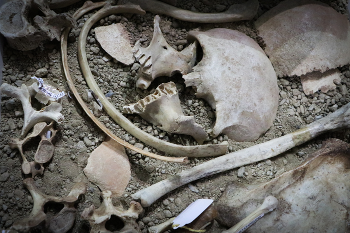 Restos humanos en un beta ahí feo