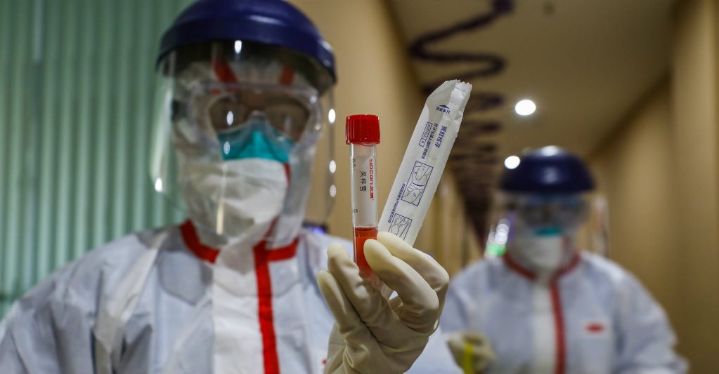 Coronavirus. AFP