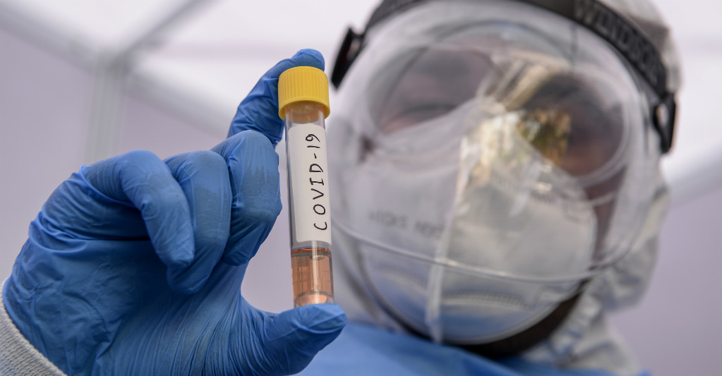 Coronavirus deja más de 75.000 muertos en el mundo. AFP