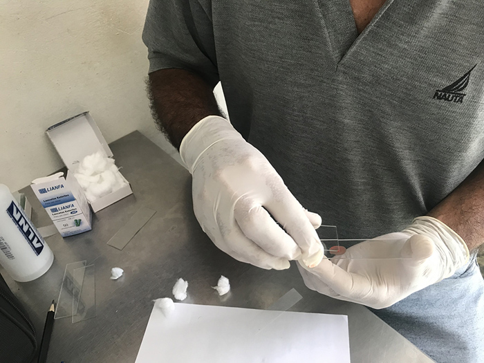 Malaria