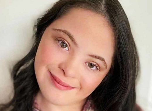 Ellie Goldstein