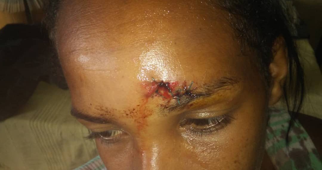 tres mujeres golpean a embarazada por recoger agua