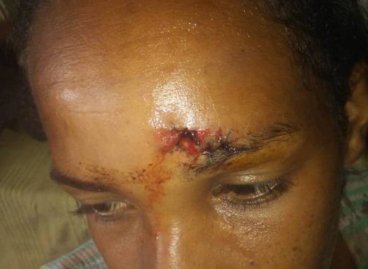 tres mujeres golpean a embarazada por recoger agua