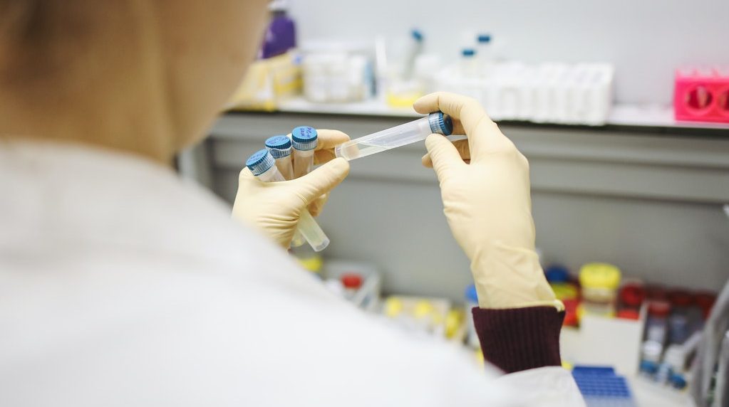 PCR