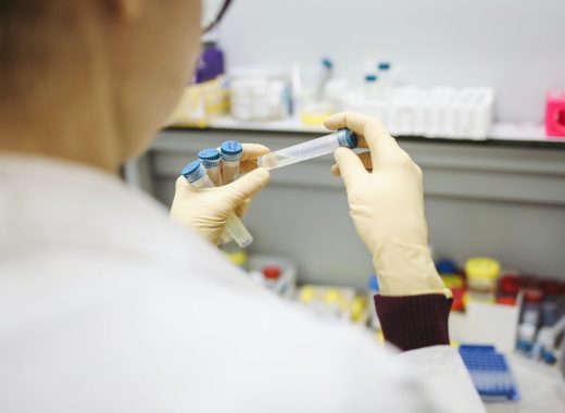 PCR