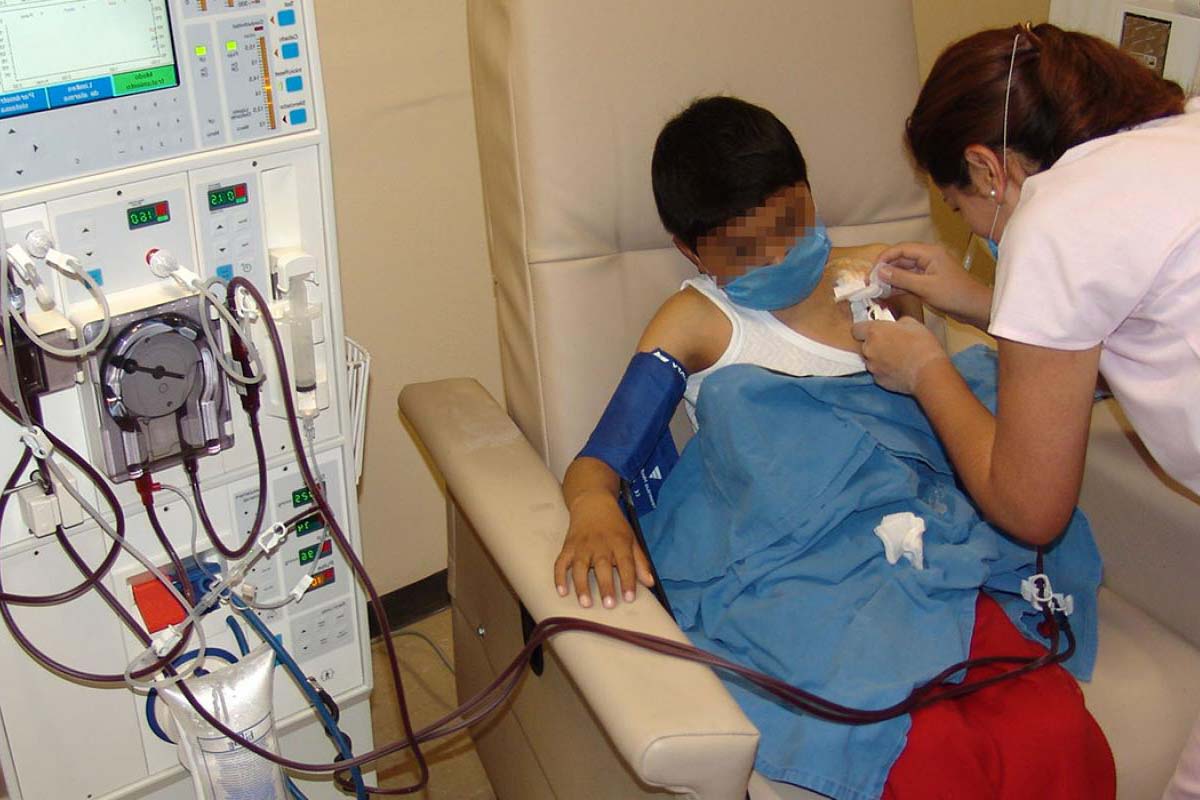 niños con enfermedad renal