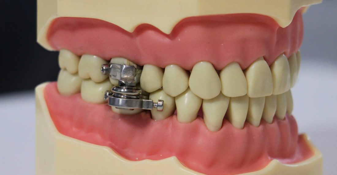 DentalSlim Diet Control