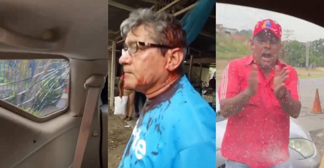 Elecciones bajo ataque del chavismo