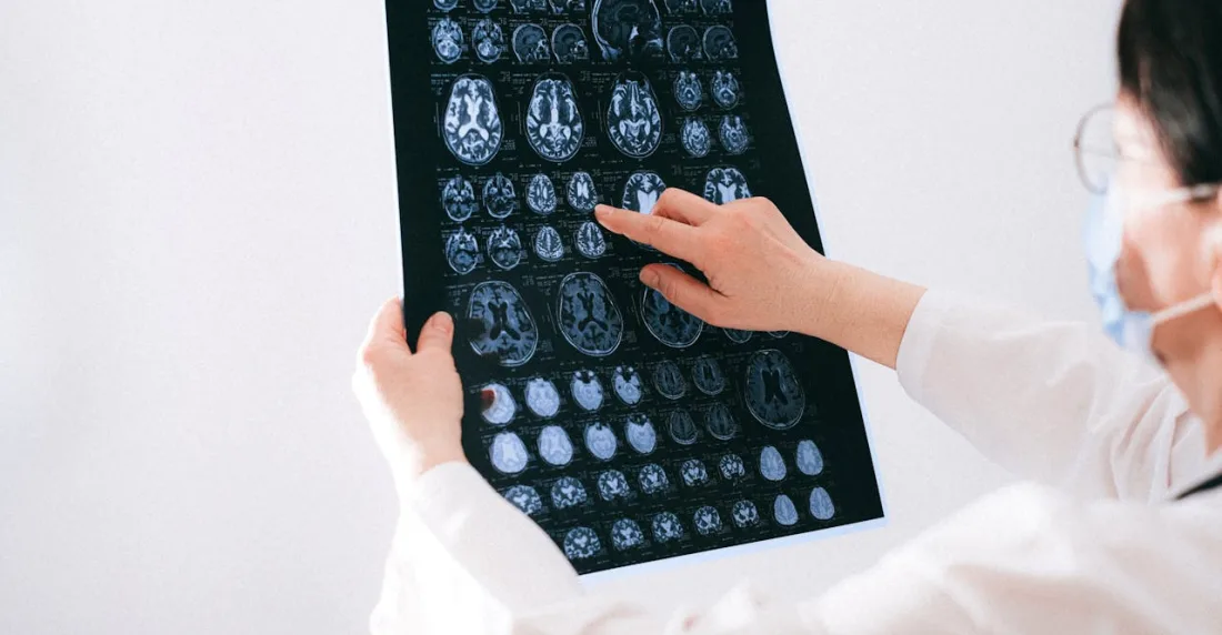 El cerebro es el gran receptor de microplásticos en el cuerpo humano