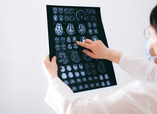 El cerebro es el gran receptor de microplásticos en el cuerpo humano