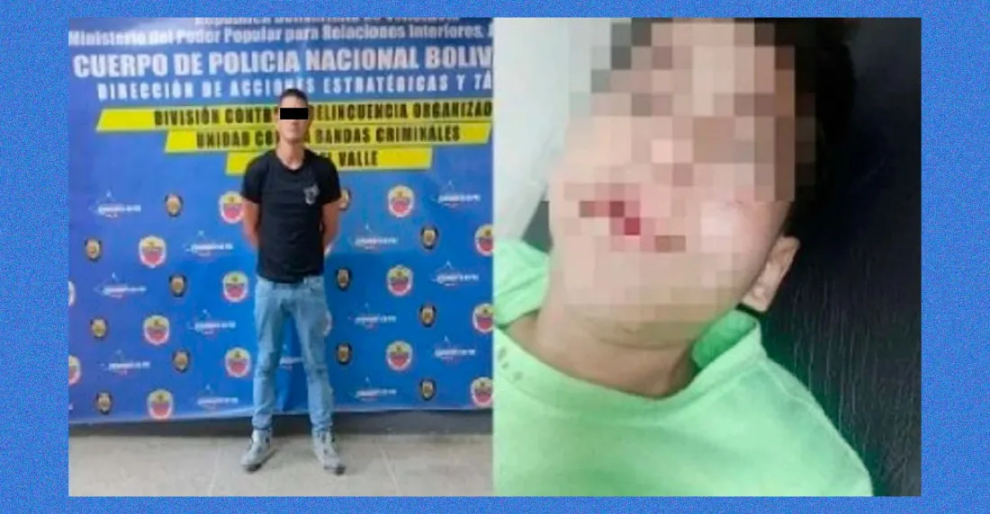 Imputado boxeador que golpeó salvajemente a 2 niños en La Vega
